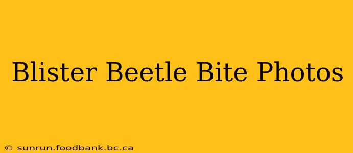 Blister Beetle Bite Photos