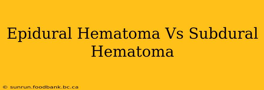 Epidural Hematoma Vs Subdural Hematoma