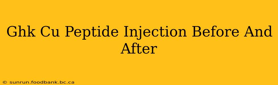 Ghk Cu Peptide Injection Before And After