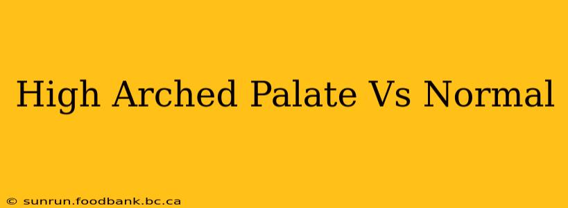 High Arched Palate Vs Normal