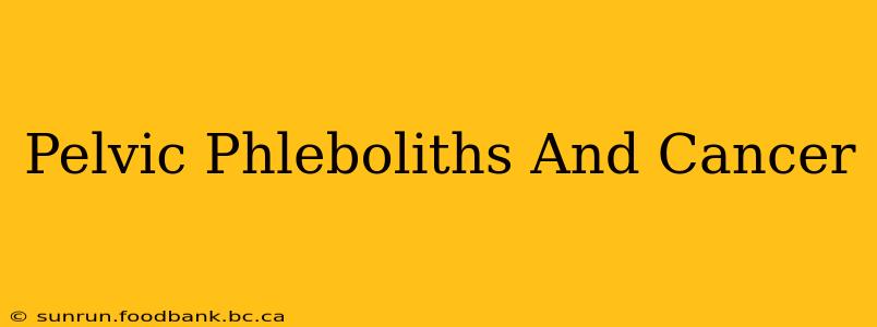 Pelvic Phleboliths And Cancer