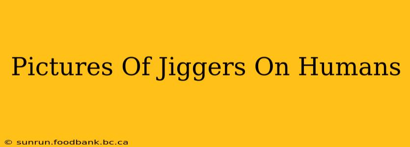 Pictures Of Jiggers On Humans