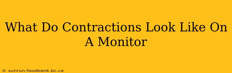 What Do Contractions Look Like On A Monitor