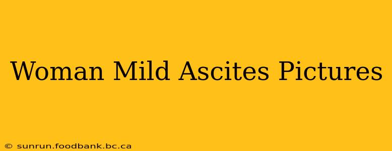 Woman Mild Ascites Pictures